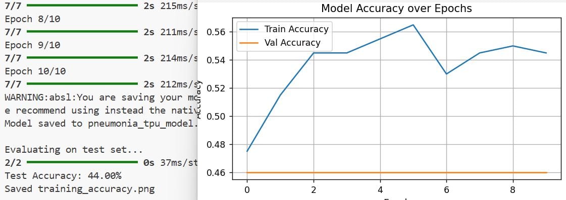 Pneumonia Classification Using TPU in Keras